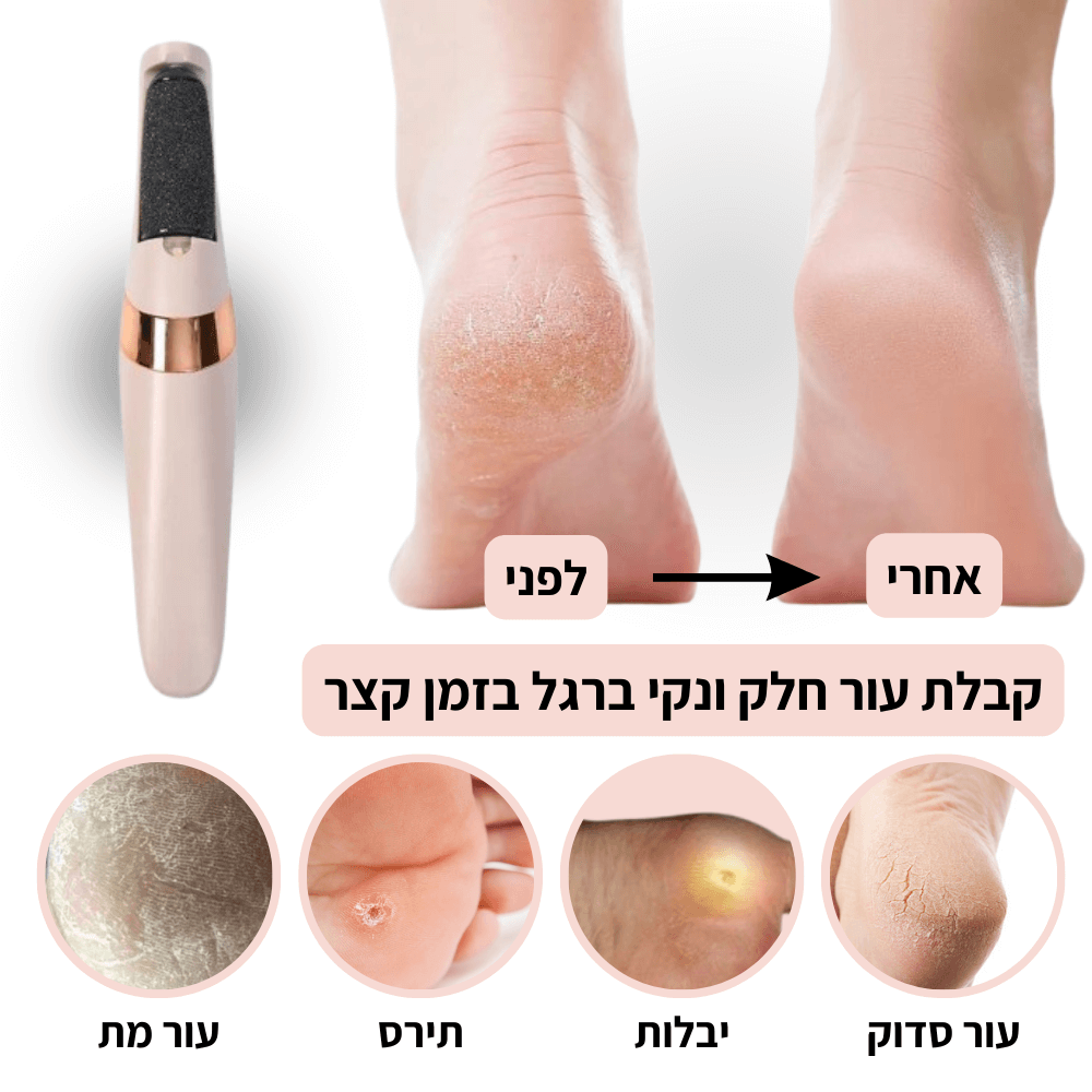 מכשיר פדיקור מבית Shoplilo | רגליים נקיות וחלקות תוך 5 דקות