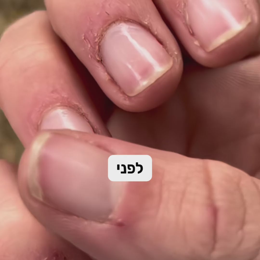טבעת לילו - מקלה על סטרס ולחץ